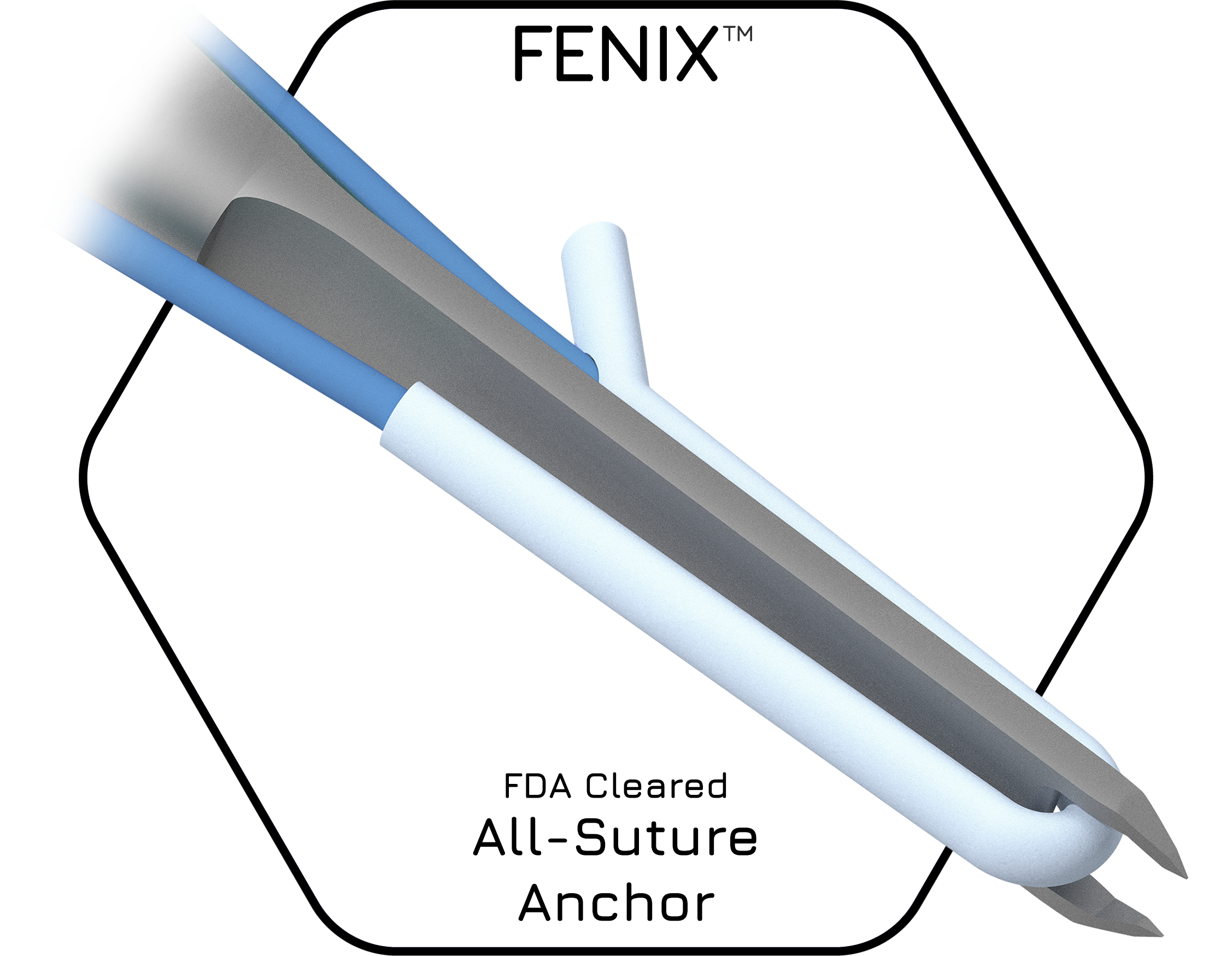 FENIX®