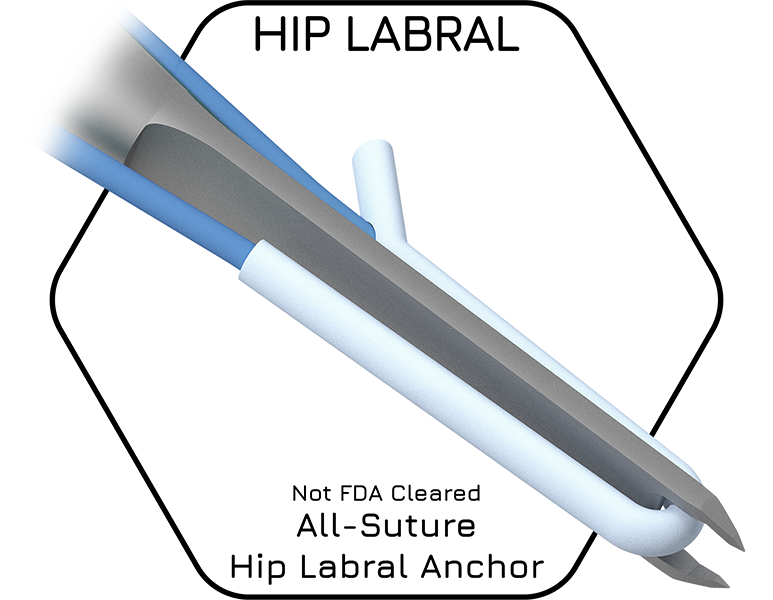 HIP-LABRAL